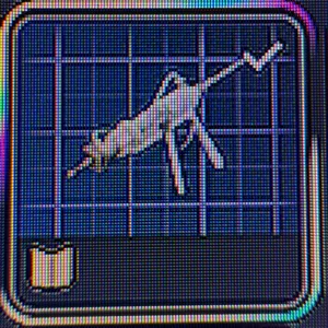 DEFIBRILLATOR BLUEPRINT